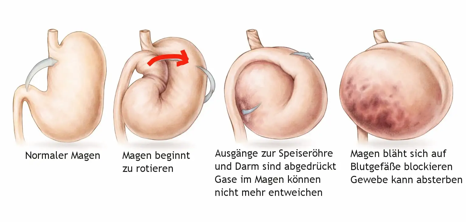 4 Stadien der Magendrehung